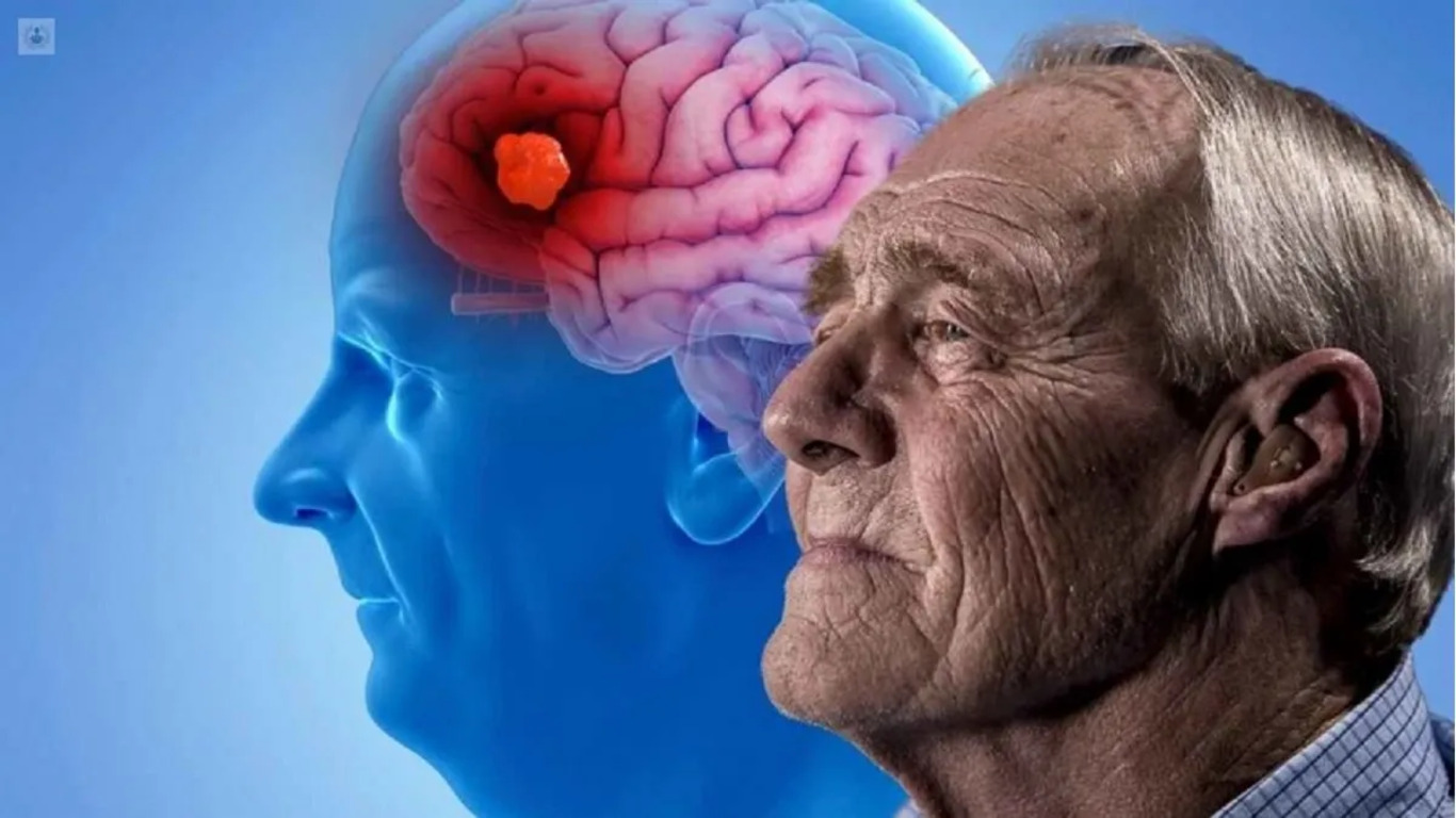 Un estudio revela cuáles son los alimentos que pueden ayudar a prevenir el Alzheimer