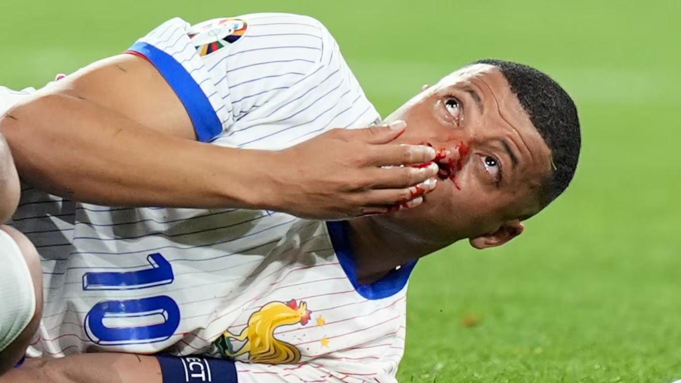 Kylian Mbappé se fractura la nariz en el partido Francia-Austria en la Eurocopa 2024 